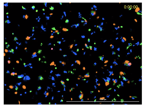 An image of our prostate cancer mixture cell line model.